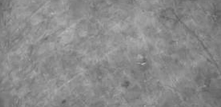 Analyse microscopique IUM Paris peau plus lisse et hydratée après 14 jours d’application