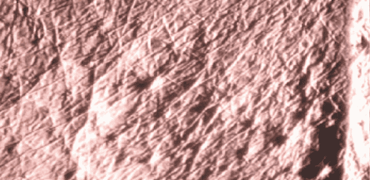 Analyse microscopique IUM Paris peau du contour des yeux après utilisation soin énergisant 28 jours
