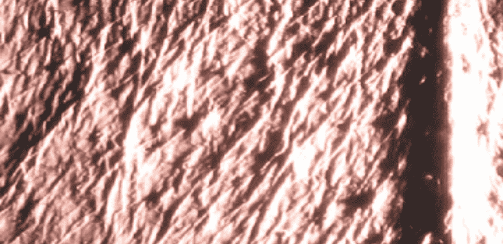 Analyse microscopique IUM Paris peau du contour des yeux avant utilisation contour des yeux